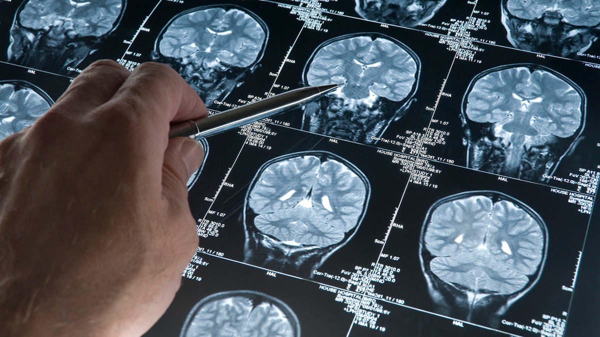 brain-scans.jpg